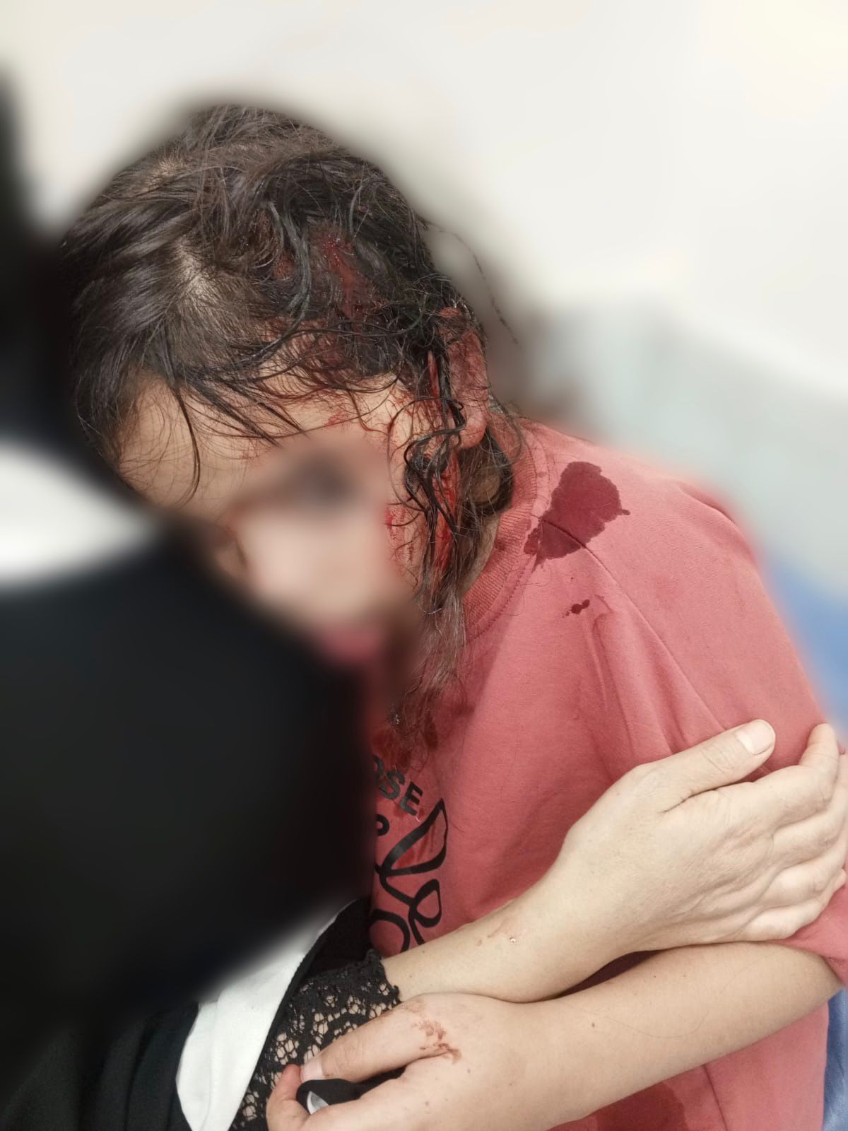 قطيع من الكلاب الضالة يهاجم الطفلة ريتال 