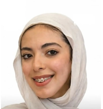 حادث دهس ينهي حلم طالبة أردنية بدراسة الطب في اليمن