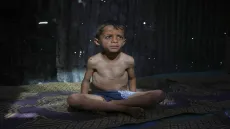 أطباء بلا حدود: مستويات مقلقة من سوء التغذية في غزة