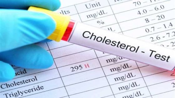 دراسة تحذر: 8 عادات يومية ترفع مستوى الكوليسترول الضار
