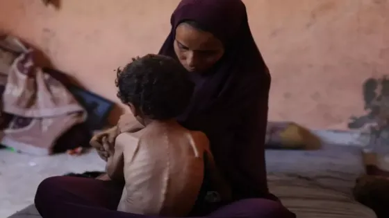 الأمم المتحدة تحذر: تأثير سوء تغذية الحوامل بغزة سيمتد لأجيال