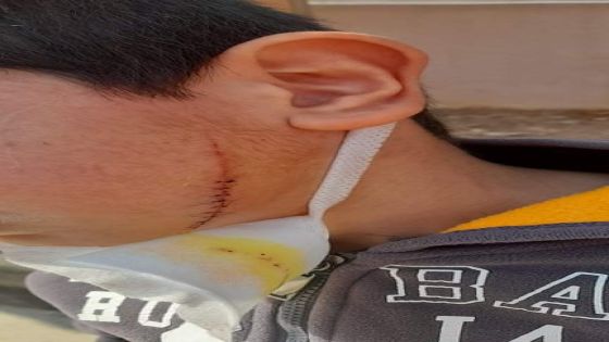 اعتداء على مدرسة للإناث في ” كريمه ” … واصابة طفل بضربة بالوجه داخلها بأداة حادة من اخر