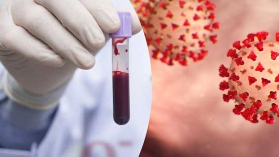 علاقة فصيلة الدم بالإصابة بفايروس كورونا