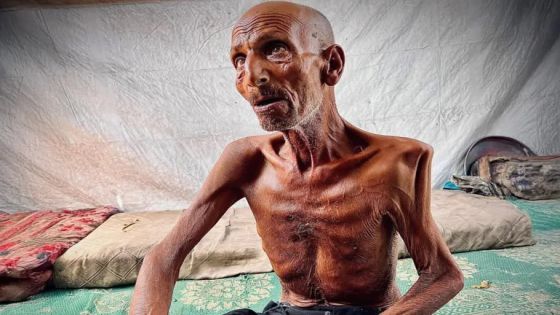 الجوع ينهش جسده.. الثمانيني سليم عصفور يصارع المجاعة في غزة