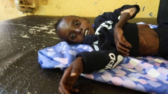 الأمم المتحدة : جوع في الفاشر وأطفال الخرطوم جلد على عظم