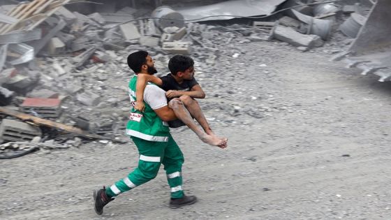 TOPSHOT - A member of the Palestinian civil defence carries a wounded boy rescued from the rubble of the Tattari family home which was destroyed in an Israeli airstrike on Gaza City on October 9, 2023. Stunned by the unprecedented assault on its territory, a grieving Israel has counted over 700 dead and launched a withering barrage of strikes on Gaza that have raised the death toll there to 493 according to Palestinian officials. (Photo by Eyad AL-BABA / AFP) (Photo by EYAD AL-BABA/AFP via Getty Images)