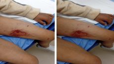 كلب ضال ينهش جسد طفل في القطرانة