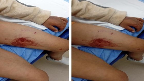 كلب ضال ينهش جسد طفل في القطرانة