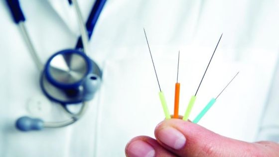 الحكومة تتجه لتنظيم مهن المعالجة بالحجامة والأعشاب والإبر الصينية