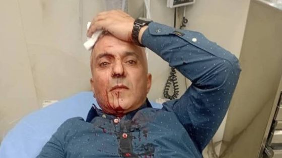 العموش يطالب بإلقاء القبض الفوري على المعتدين على الصحفي الحباشنة: نحن في دولة قانون