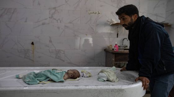 epa11793927 The body of three-week-old girl Sila lies on an autopsy table as her father (R) looks on, in the morgue of the Nasser Hospital in Khan Younis, southern Gaza Strip, 25 December 2024 (issued 26 December 2024). According to forensic doctors at the hospital, the baby died of exposure to extreme cold inside her tent in Mawasi.