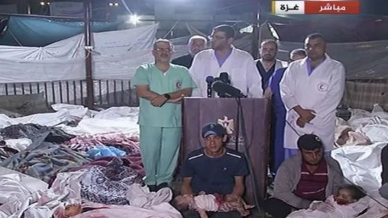 فقط في غزة .. عمليات جراحية دون تخدير ومؤتمر صحافي وسط الجثث