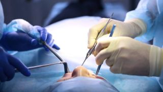 جراحة ثورية في فرنسا: أعمى يستعيد بصره بفضل زرع قطعة سن في عينه