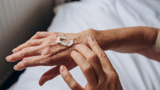 ابتكار صيني ينقل الإنسولين عبر الجلد بكريم موضعي