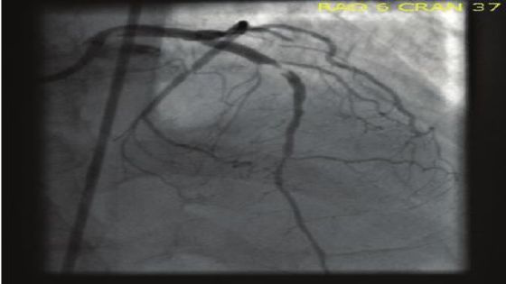 التكنولوجيا الذكية في خدمة الطب : ضرورة تفعيل تطبيقات تخطيط القلب في الأردن