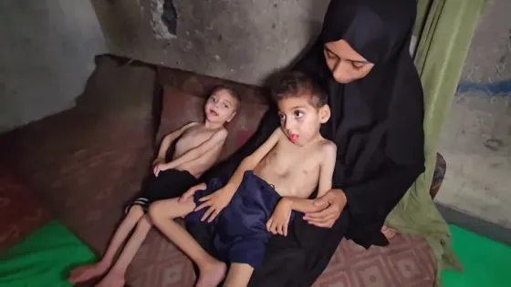 في غضون 24 ساعة.. وفاة 7 فلسطينيين بسبب المجاعة في غزة