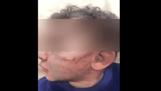 الأمن يوقف أردنيا عذب طفله الصغير بطريقة وحشية