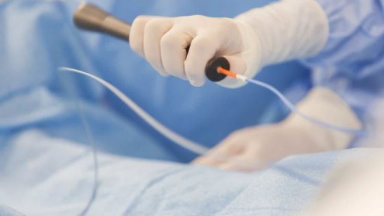 البدور: إجراء 182 قسطرة إنقاذ حياة خلال بروتوكول الجلطات القلبية في شباط