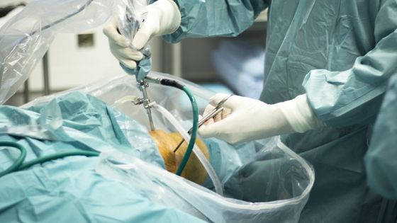 Knee arthroscopy orthopedic surgery operation in hospital emergency operating room photo.