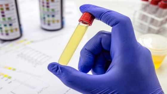 النائب المعادات يطالب بإجراء فحص تعاطي المخدرات لطلبة الجامعات