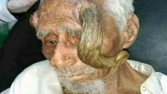 وفاة المعمر اليمني ذي القرنين عن عمر ناهز 140 عاما