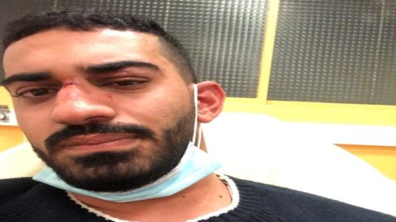 اعتداء عنصري على شاب أردني وشقيقته في فرنسا
