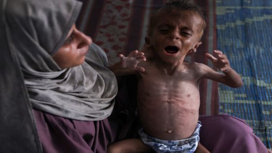 الأونروا : أسوأ سيناريوهات المجاعة يتحقق حاليا في قطاع غزة