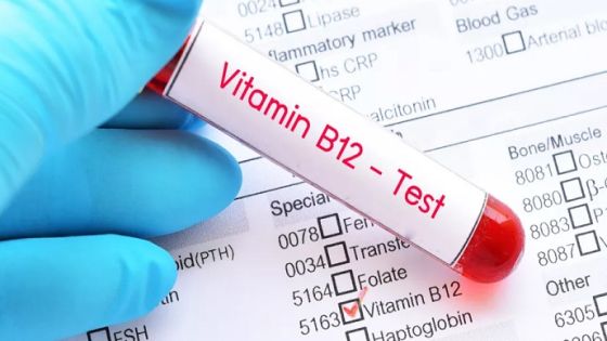 الصحة: تأمين فحوصات فيتامين D وB12 الأسبوع المقبل