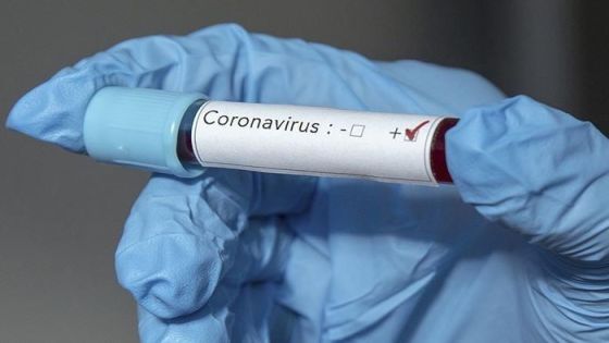 #عاجل تسجيل 7 وفيات و 502 إصابة جديدة بفيروس كورونا