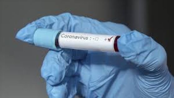 6 حالات وفاة و823 إصابة بفيروس كورونا منها 820 محلية