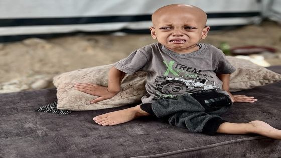 لم يحتمل الألم.. وفاة الطفل الغزاوي عبدالله أبوزرقة من شدة الجوع