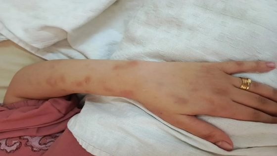 وفاة أردنية إثر تعرضها للتعذيب والضرب على يد زوجها