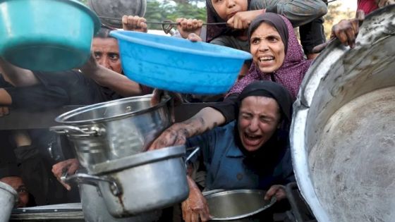 وفاة طفلة جديدة.. أعداد غير مسبوقة من المجوعين يصلون لمستشفيات قطاع غزة
